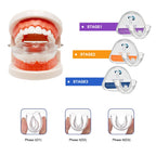 3-Stage Adult Teeth Straightening Trainer Orthodontic Mouthpiece