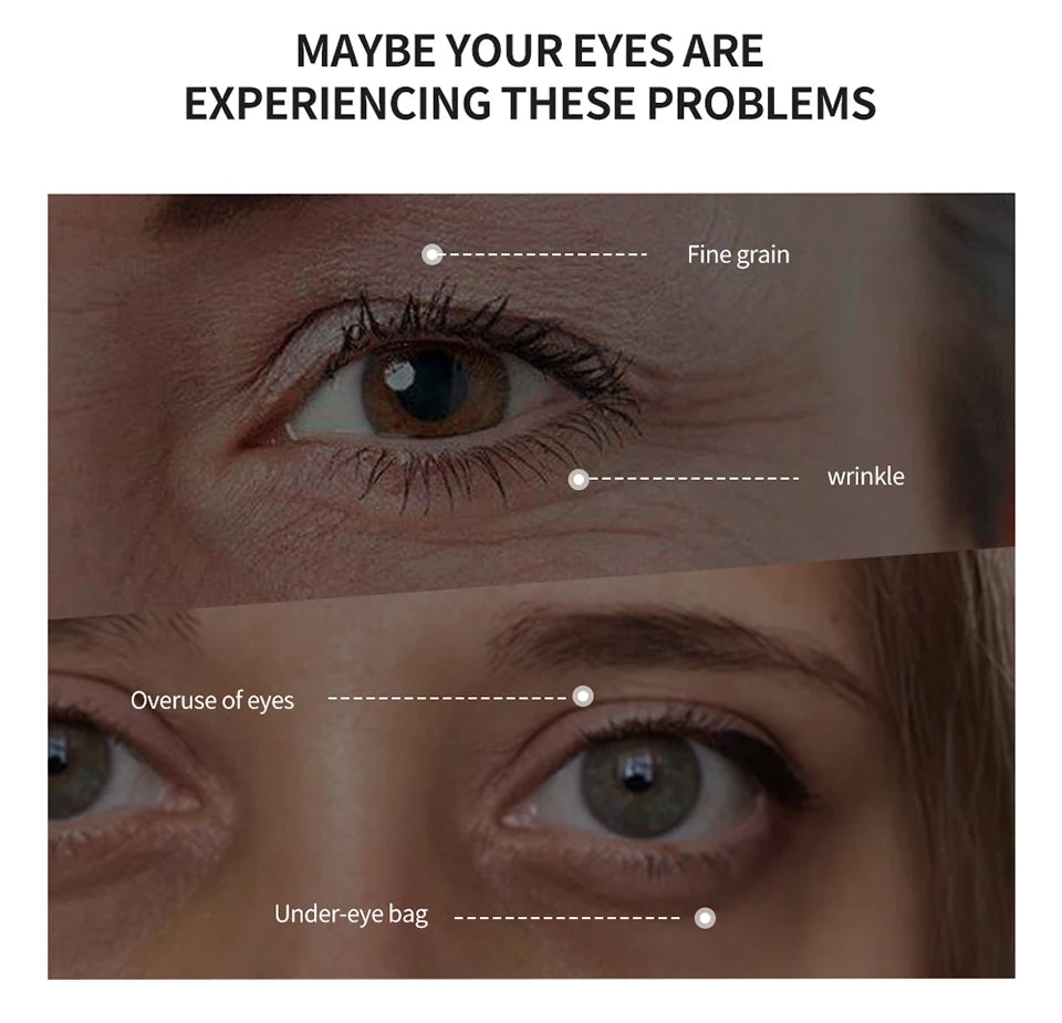 Temporary Eye Tightening Cream for Fine Lines and Wrinkles - 11