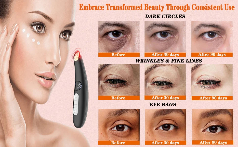 3-in-1 LED Vibration Eye and Face Lifting Wand - 10