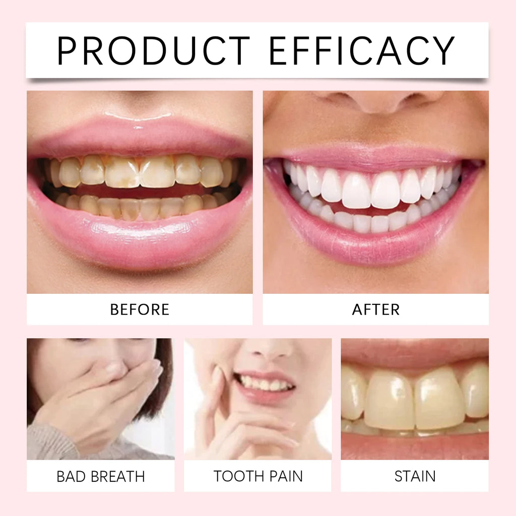 Teeth Whitening and Cavity Repair Mint Toothpaste