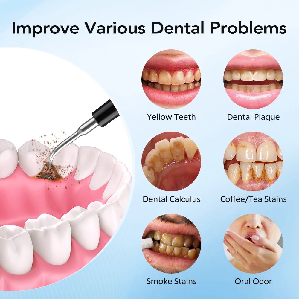 Electric Sonic Teeth Cleaner and Tartar Remover