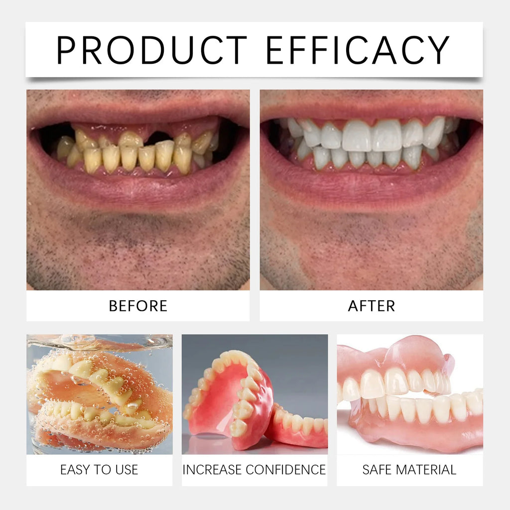 Silicone Cosmetic Denture Kit for Smile Restoration