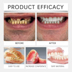 Silicone Cosmetic Denture Kit for Smile Restoration