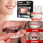 Comfort Denture Adhesive Support for Missing Teeth