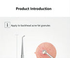 Stainless Steel Blackhead and Pimple Extractor Kit
