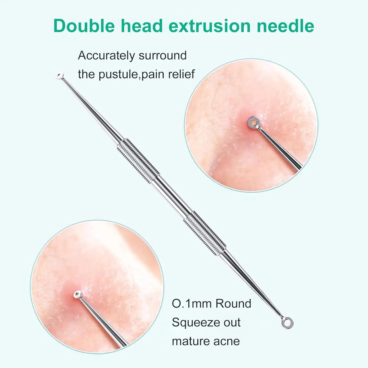 Stainless Steel Blackhead and Pimple Extractor Kit - 3