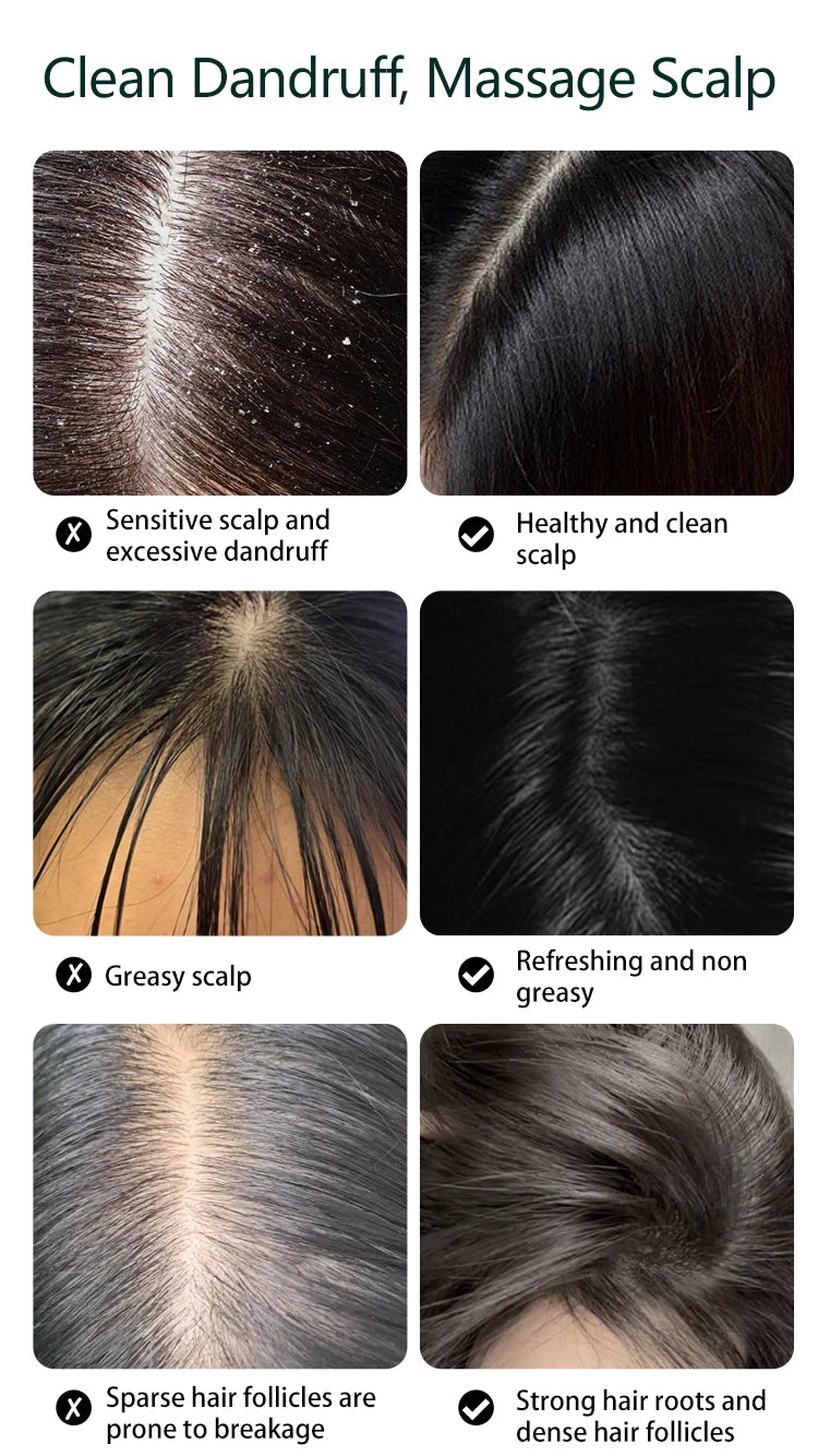 Electric Waterproof Scalp Massager for Relaxation