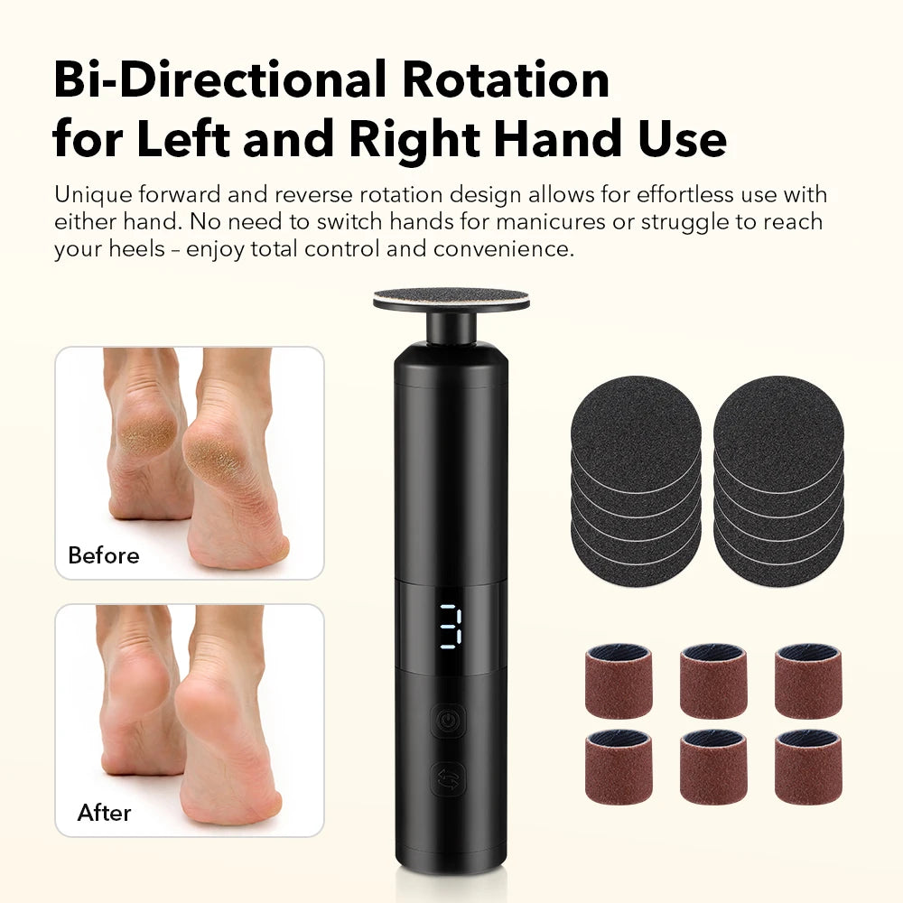Electric Callus Remover for Smooth Heels and Pedicures