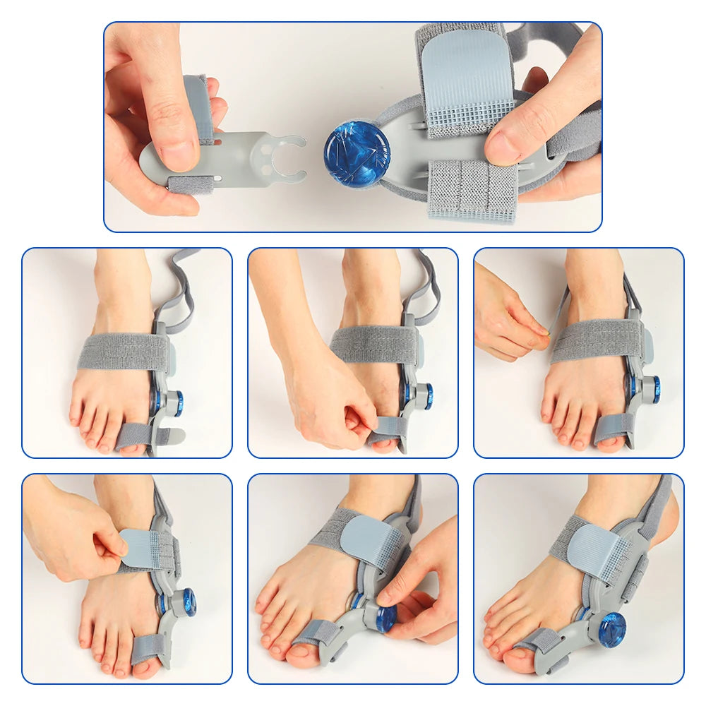 Adjustable Bunion Corrector for Hallux Valgus Support
