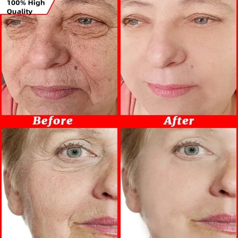 Anti-Wrinkle Moisturizing Face Cream for Firming and Lifting - 2