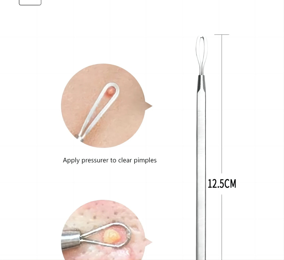Stainless Steel Blackhead and Pimple Extractor Kit