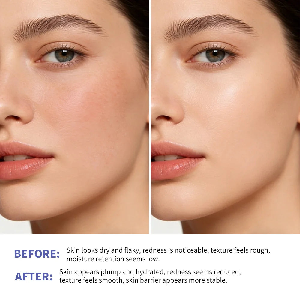 Triple Lipid Peptide Moisturizing Face Cream for Dry Skin