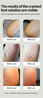 Electric Foot Callus Remover with 6 Adjustable Speeds