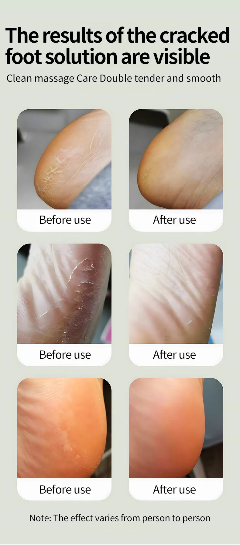 Electric Foot Callus Remover with 6 Adjustable Speeds