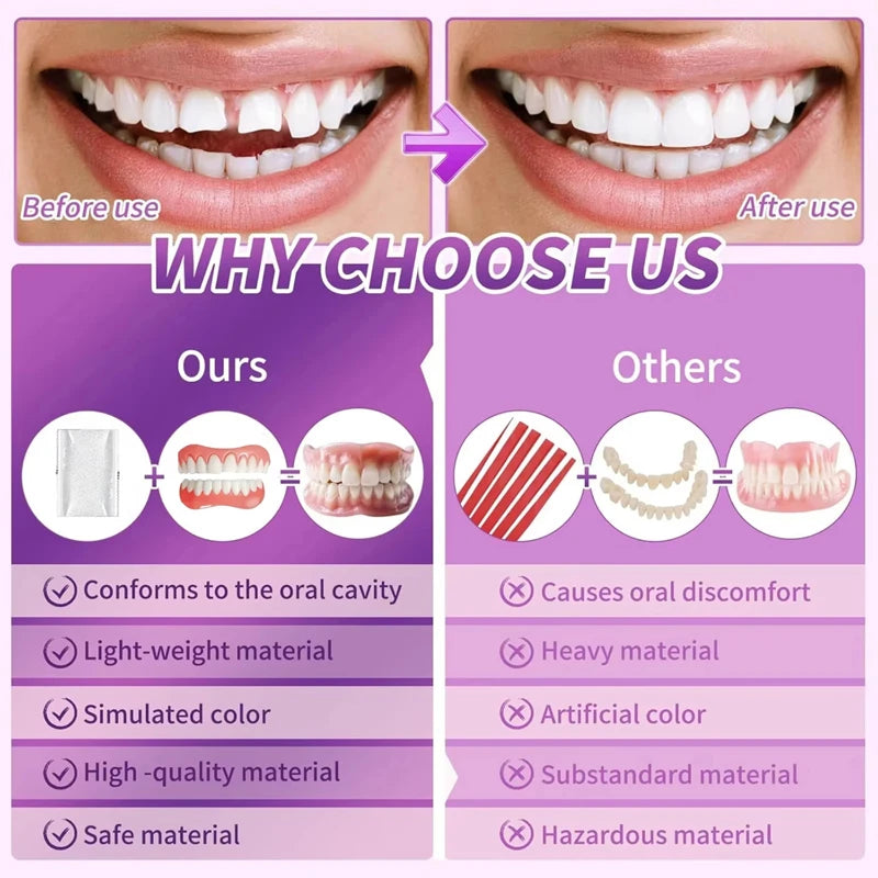 Comfort Silicone Dentures for Instant Smile Enhancement