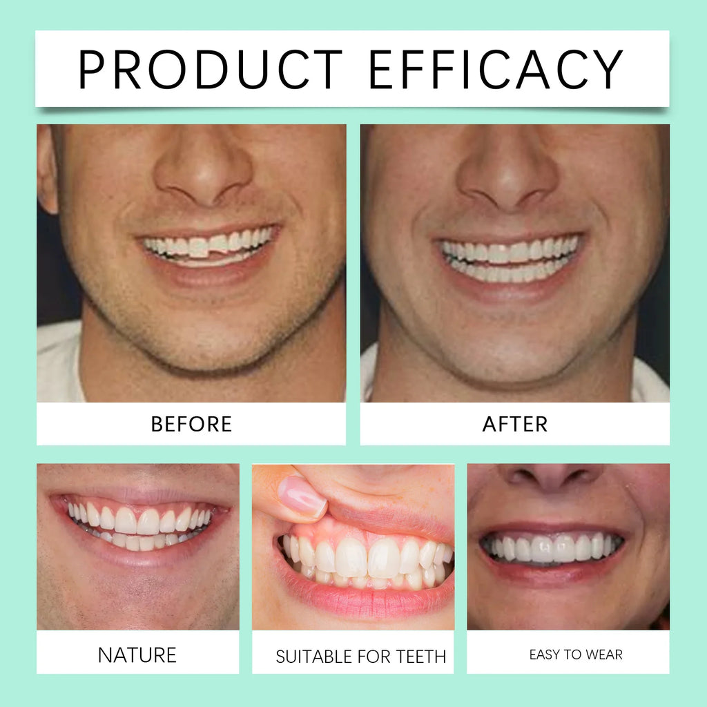 Flexible Silicone Cosmetic Denture Set for Smile Restoration