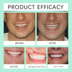 Flexible Silicone Cosmetic Denture Set for Smile Restoration
