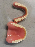 Moldable Silicone Cosmetic Denture Kit