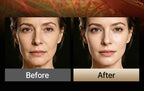 LED Facial and Body Sculpting Beauty Device