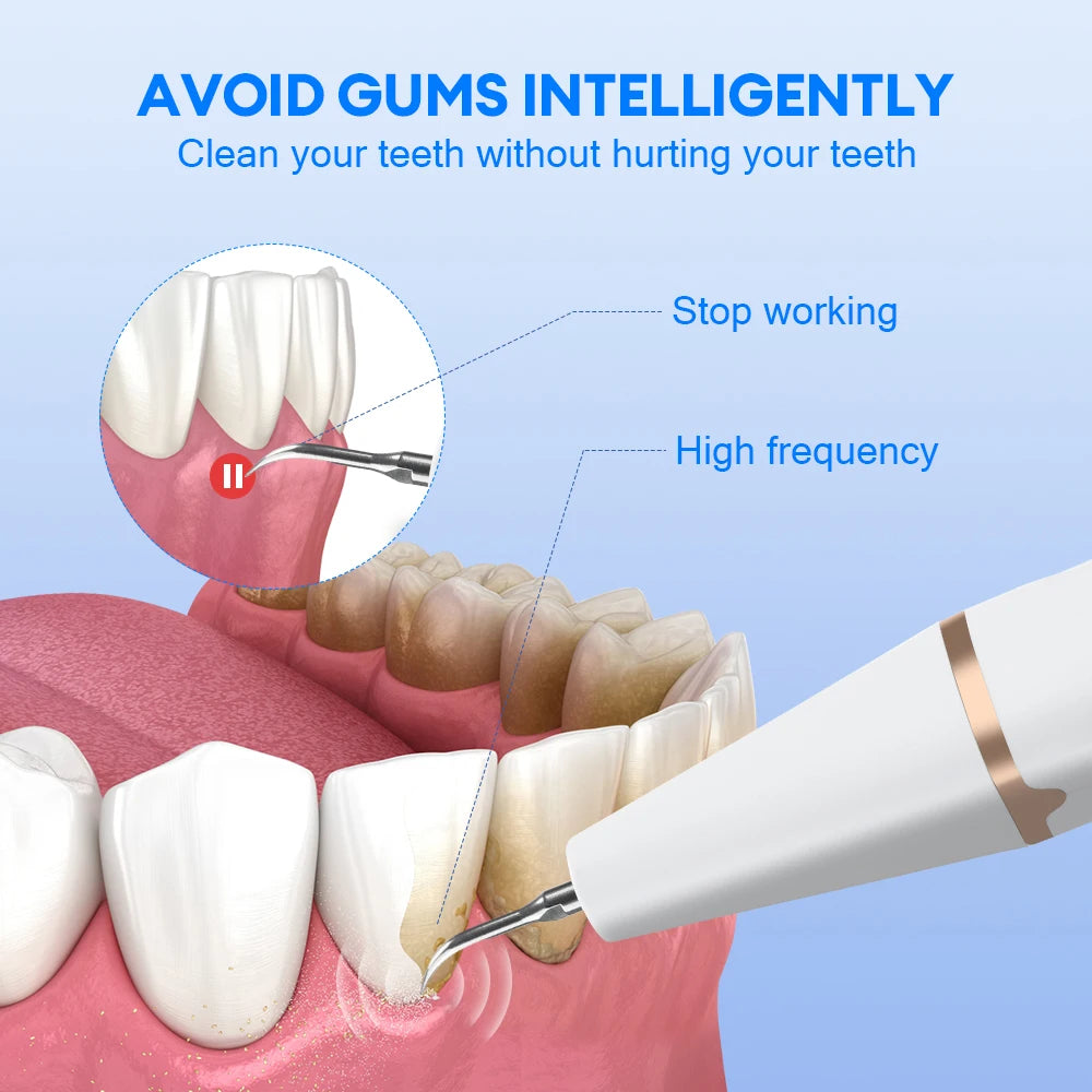 Ultrasonic Electric Dental Tartar and Plaque Remover