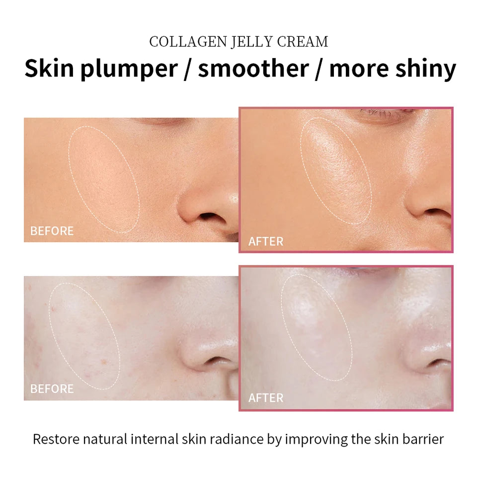 Collagen Skincare Kit for Deep Hydration and Skin Elasticity