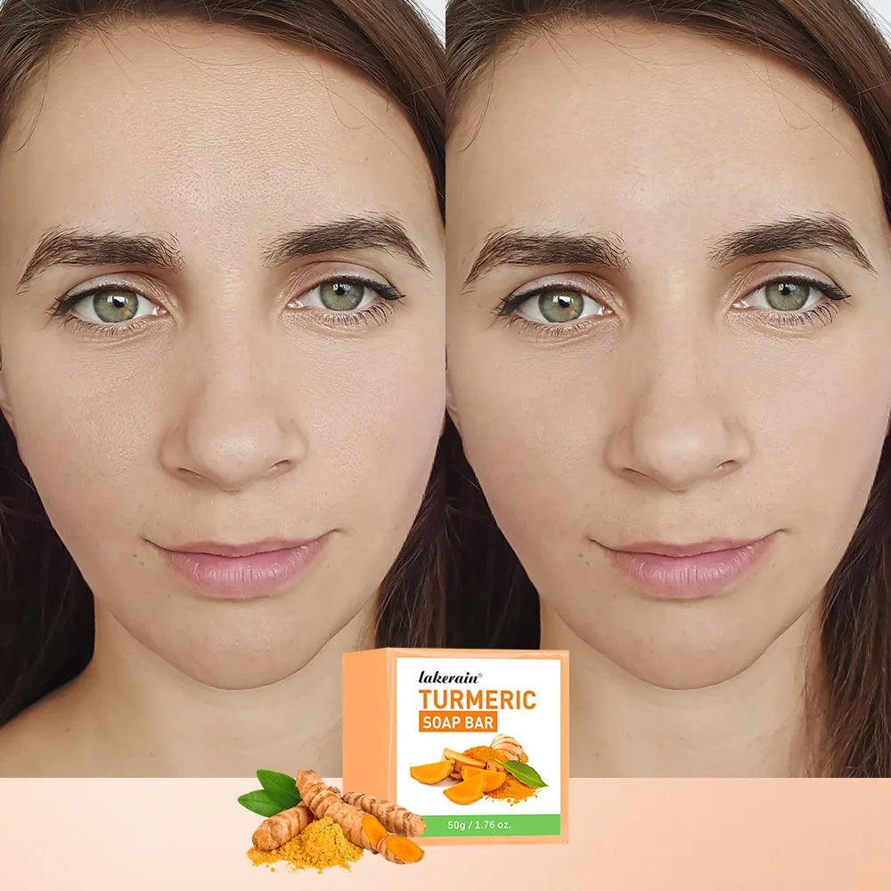 Brightening Turmeric Soap Bar for Face and Body