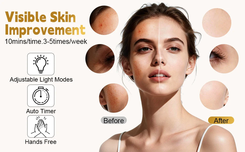 7-Color LED Silicone Facial Light Therapy Mask