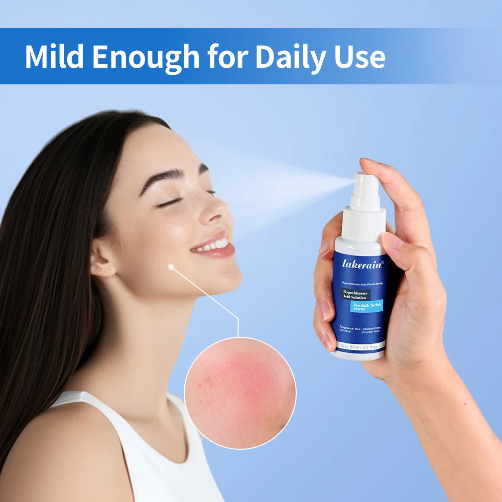Hypochlorous Acid Facial Spray for Acne and Sensitive Skin