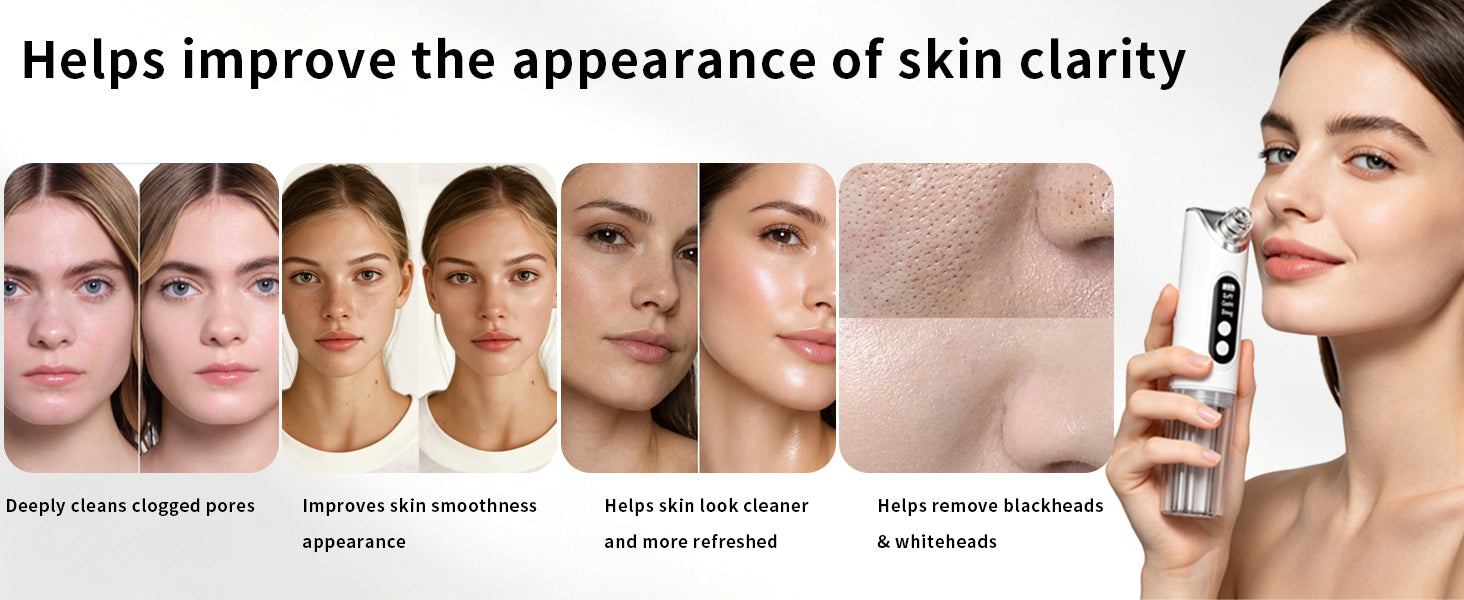 Hydrating Pore Vacuum Blackhead Remover with 6 Suction Heads - 10